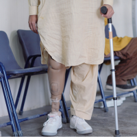 Artificial Limbs Implantation